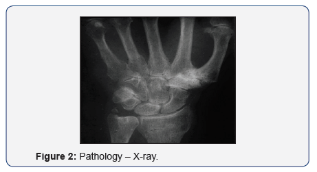 Click here to view Large Figure 2