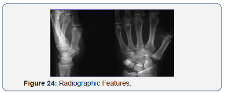 Click here to view Large Figure 24