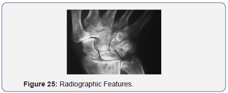 Click here to view Large Figure 25
