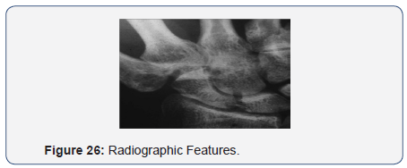Click here to view Large Figure 26