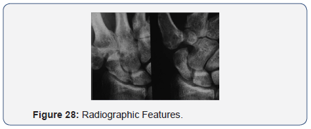 Click here to view Large Figure 28