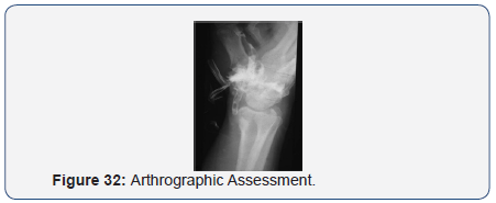 Click here to view Large Figure 32