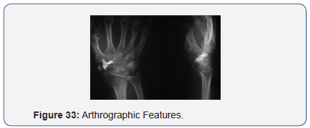 Click here to view Large Figure 33