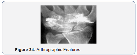 Click here to view Large Figure 34