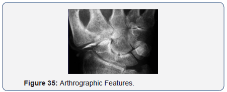 Click here to view Large Figure 35