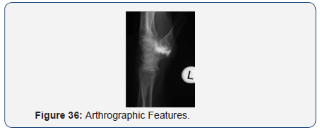 Click here to view Large Figure 36