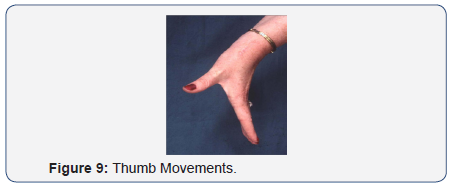 Click here to view Large Figure 9