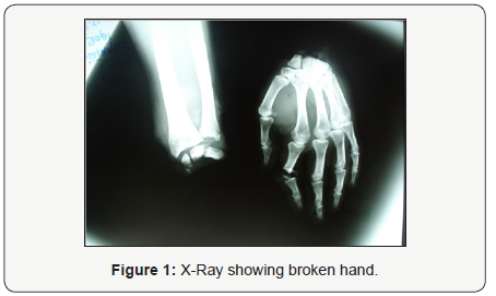 Click here to view Large Figure 1