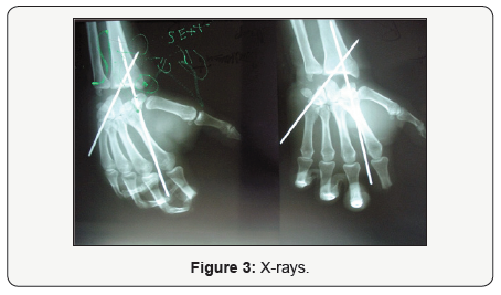 Click here to view Large Figure 3