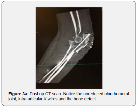 Click here to view Large Figure 3a