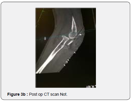 Click here to view Large Figure 3b