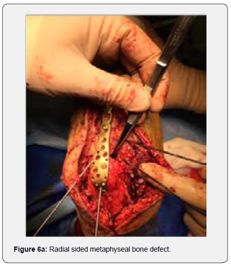 Click here to view Large Figure 3b