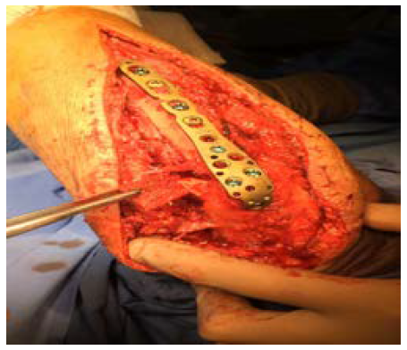 Click here to view Large Figure 6c