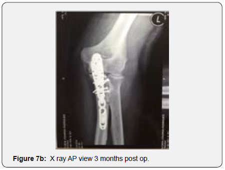 Click here to view Large Figure 7b