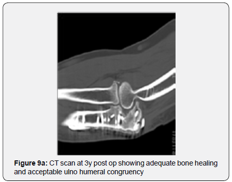 Click here to view Large Figure 9a