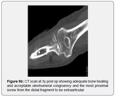 Click here to view Large Figure 9b