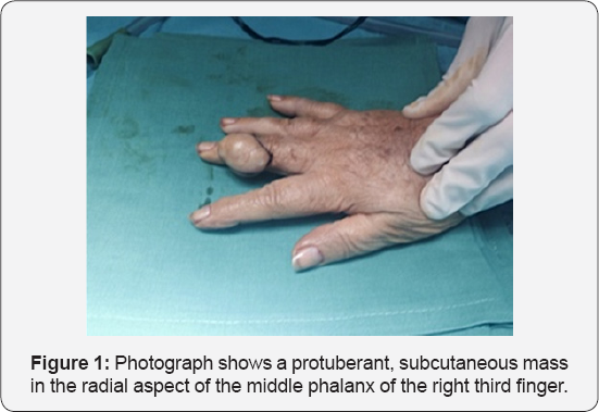 Click here to view Large Figure 1