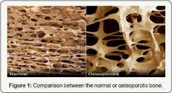 Click here to view Large Figure 1