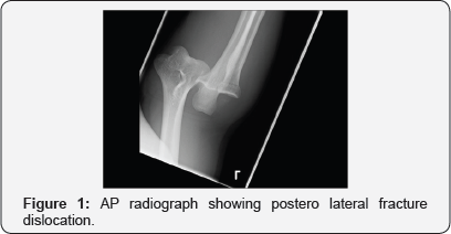 Click here to view Large Figure 1