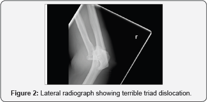 Click here to view Large Figure 2