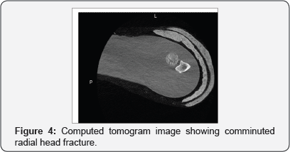 Click here to view Large Figure 4