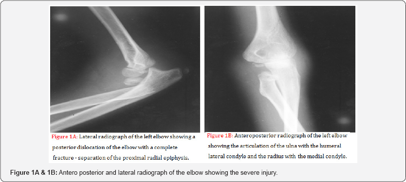 Click here to view Large Figure 1