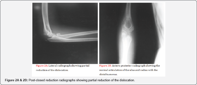 Click here to view Large Figure 2