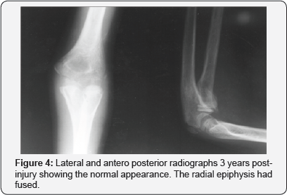 Click here to view Large Figure 4