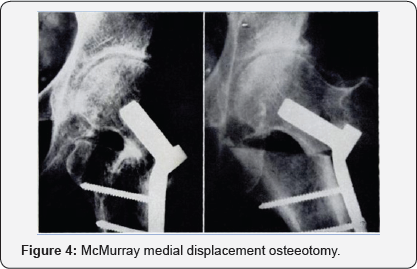 Click here to view Large Figure 4