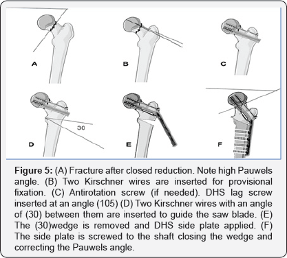 Click here to view Large Figure 5
