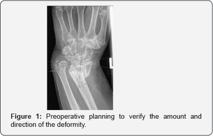 Click here to view Large Figure 1