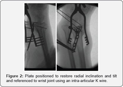 Click here to view Large Figure 2