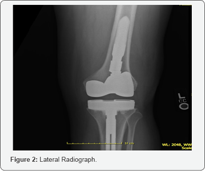 Click here to view Large Figure 2