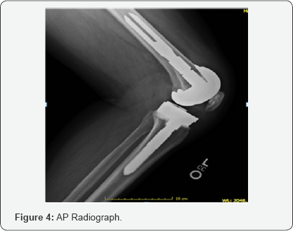 Click here to view Large Figure 4