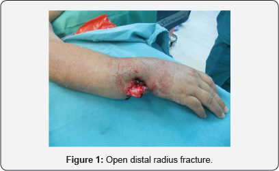 Click here to view Large Figure 1