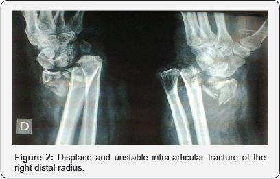 Click here to view Large Figure 2