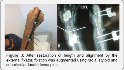 Click here to view Large Figure 3
