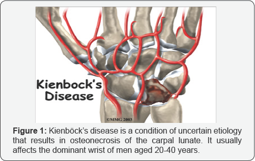 Click here to view Large Figure 1