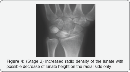 Click here to view Large Figure 4