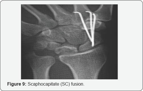 Click here to view Large Figure 9