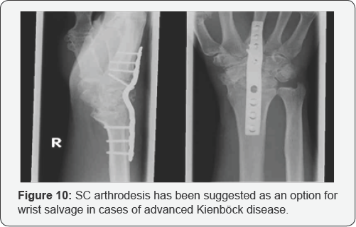 Click here to view Large Figure 10