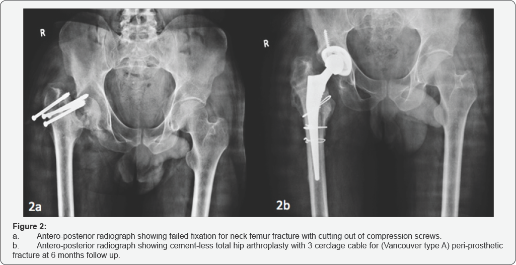 Click here to view Large Figure 2