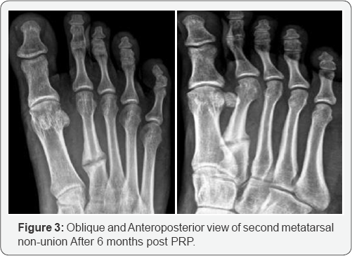 Click here to view Large Figure 1