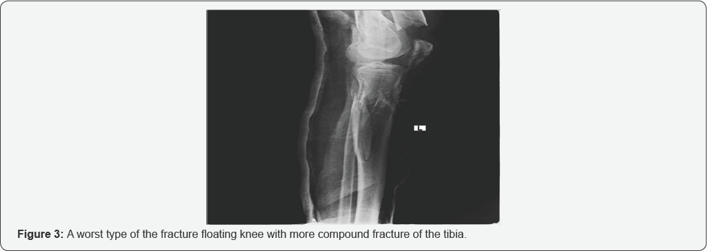 Click here to view Large Figure 1