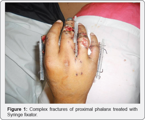 Click here to view Large Figure 1