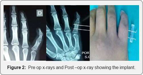 Click here to view Large Figure 2