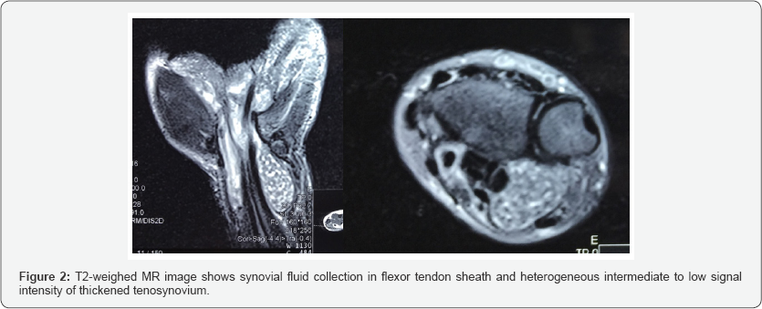 Click here to view Large figure 2