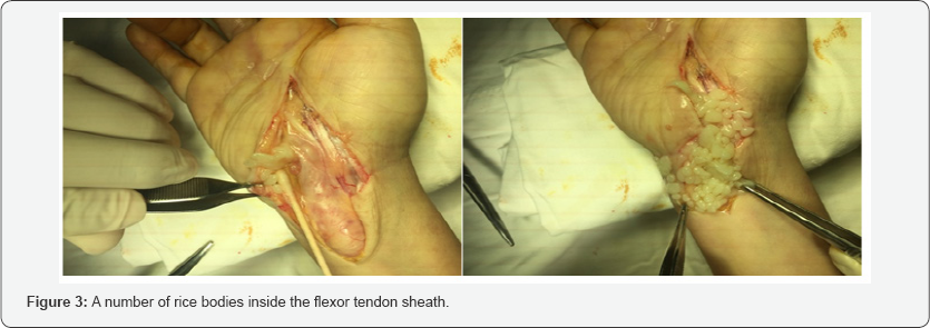 Click here to view Large figure 3