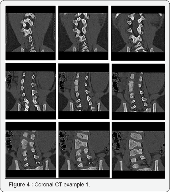 Click here to view Large Figure 4