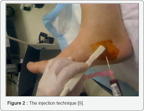 Click here to view Large Figure 2